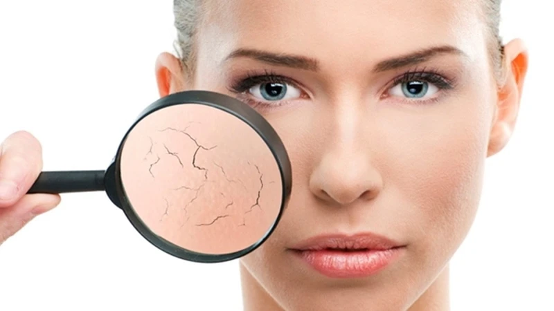 Hàng Rào Bảo Vệ Da Là Gìmoin