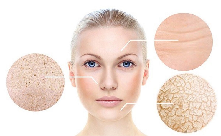 Hàng Rào Bảo Vệ Da Là Gìmoin